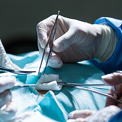 What are the Different Types of Surgical Forceps?